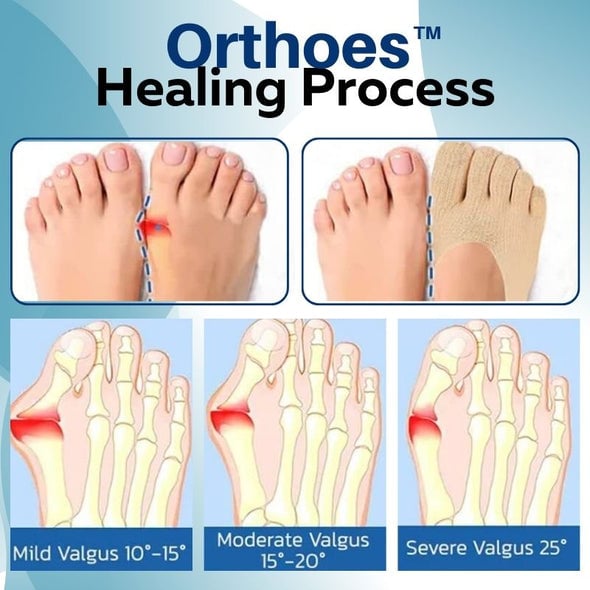 Skarpety ortopedyczne Orthoes™