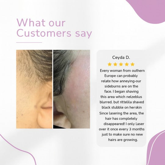 Urządzenie do usuwania włosów IPL Ylvis – gładka skóra bez włosów w domu