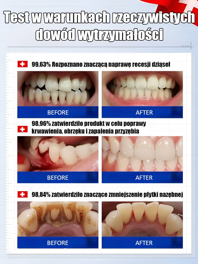 Hydroksyapatyt Whitening Pasta do zębów