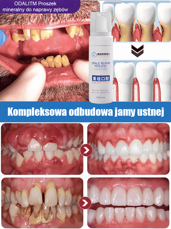 Medyczna pianka regeneracyjna do jamy ustnej klasy medycznej