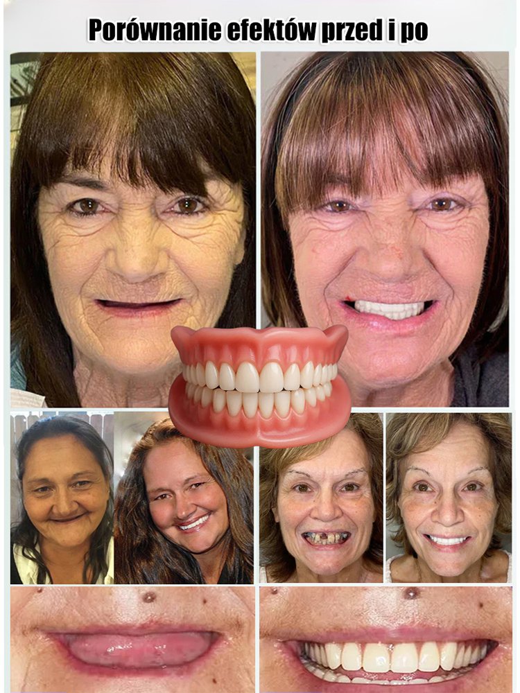 Komfortowe, naturalnie przylegające nakładki na górne i dolne zęby