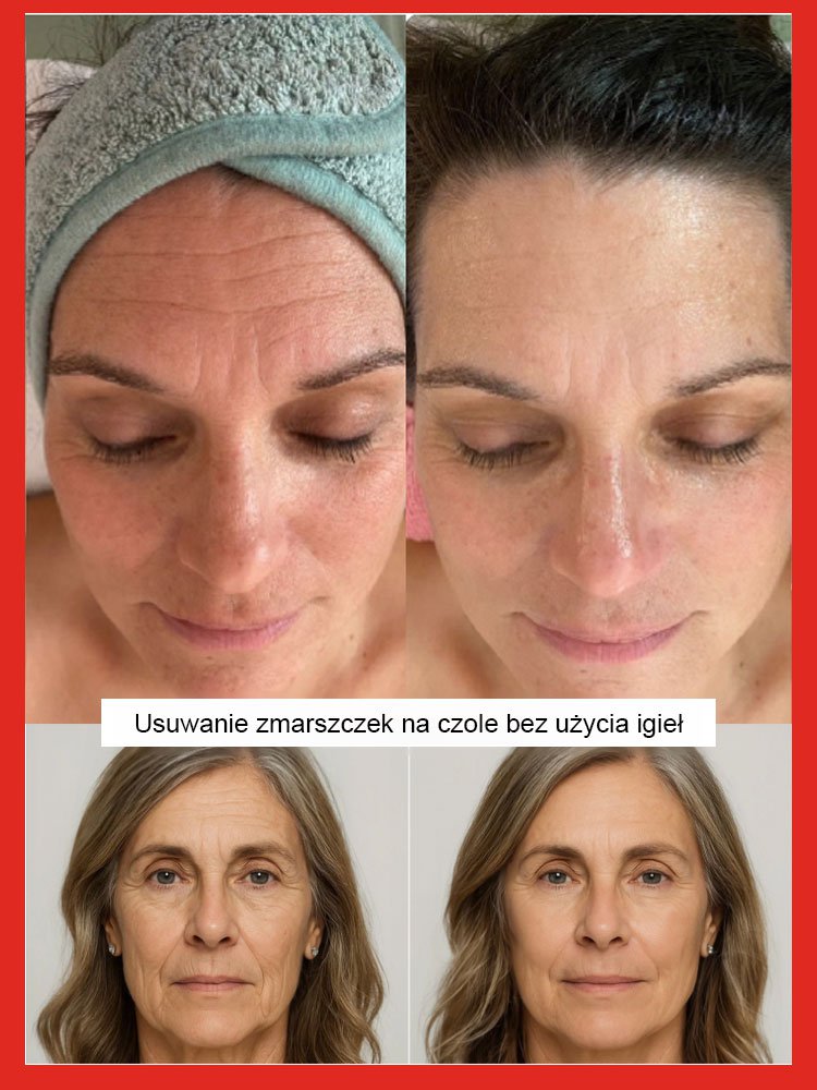 Lekka Serum Przeciwzmarszczkowe Z Wodą z Łososia