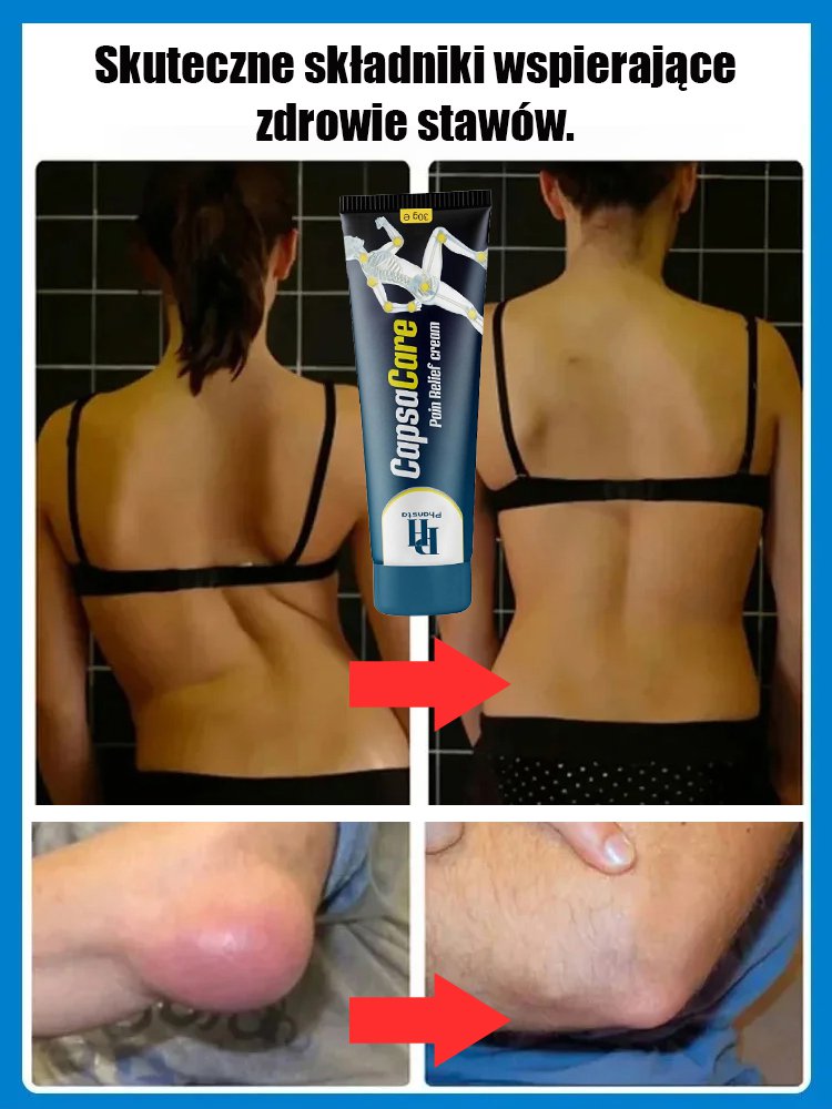 Krem na objawy neuropatii