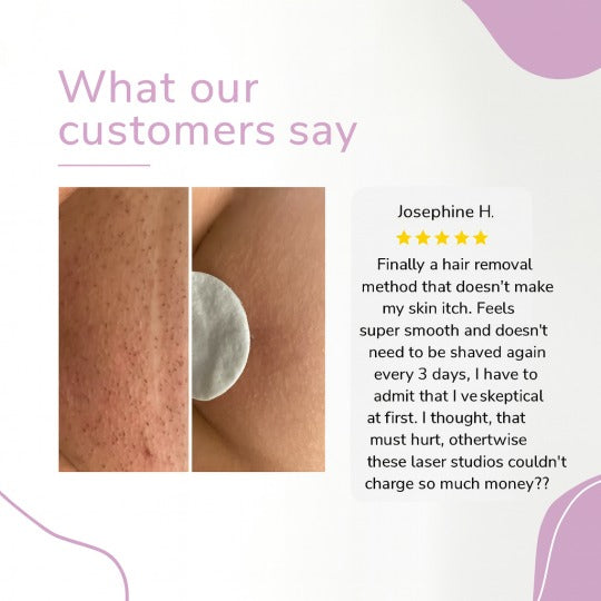 Urządzenie do usuwania włosów IPL Ylvis – gładka skóra bez włosów w domu