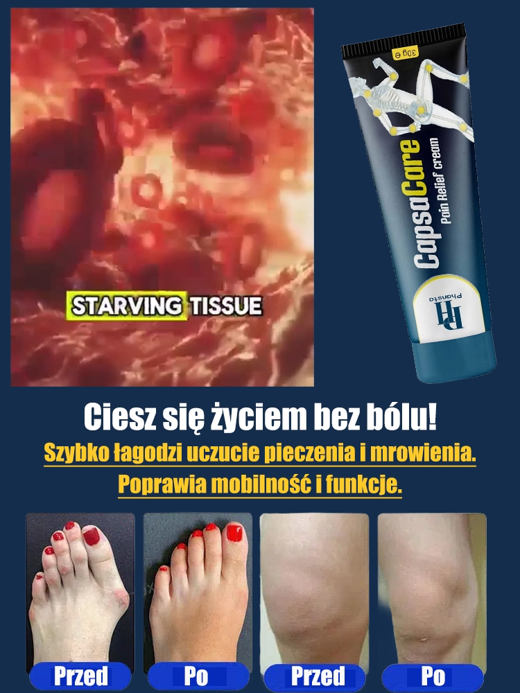 Krem na objawy neuropatii